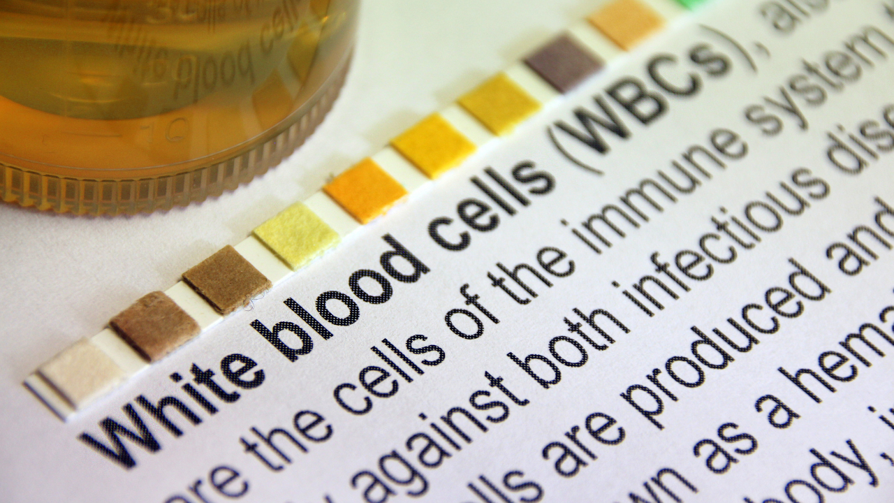 Understanding Low White Blood Cells (WBCS) in Communities of Color: Questions to Ask Your Doctor About Duffy-Null Associated Neutrophil Count (DANC)